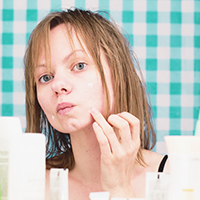 Key skincare ingredients for acne: What should you look for?