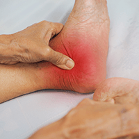 A new treatment for ankle arthritis