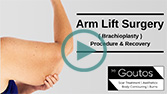 Brachioplasty / Arm Lift Surgery - Procedure and Recovery