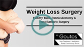 Weight Loss Surgery - Tummy Tuck, Panniculectomy and Bariatric Surgery