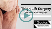 Thigh lift Surgery - Procedure and Recovery Tips