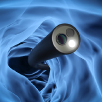 Endoscopic management of an internal laryngopyocele presenting with acute airway obstruction