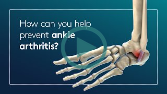 How can you help prevent ankle arthritis?